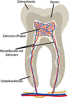  Seitenansicht eines Zahnes mit Zahnschmelz, Dentin, Zahnnerv, Wurzelkanälen mit Zahnnerv und Seitenkanälchen